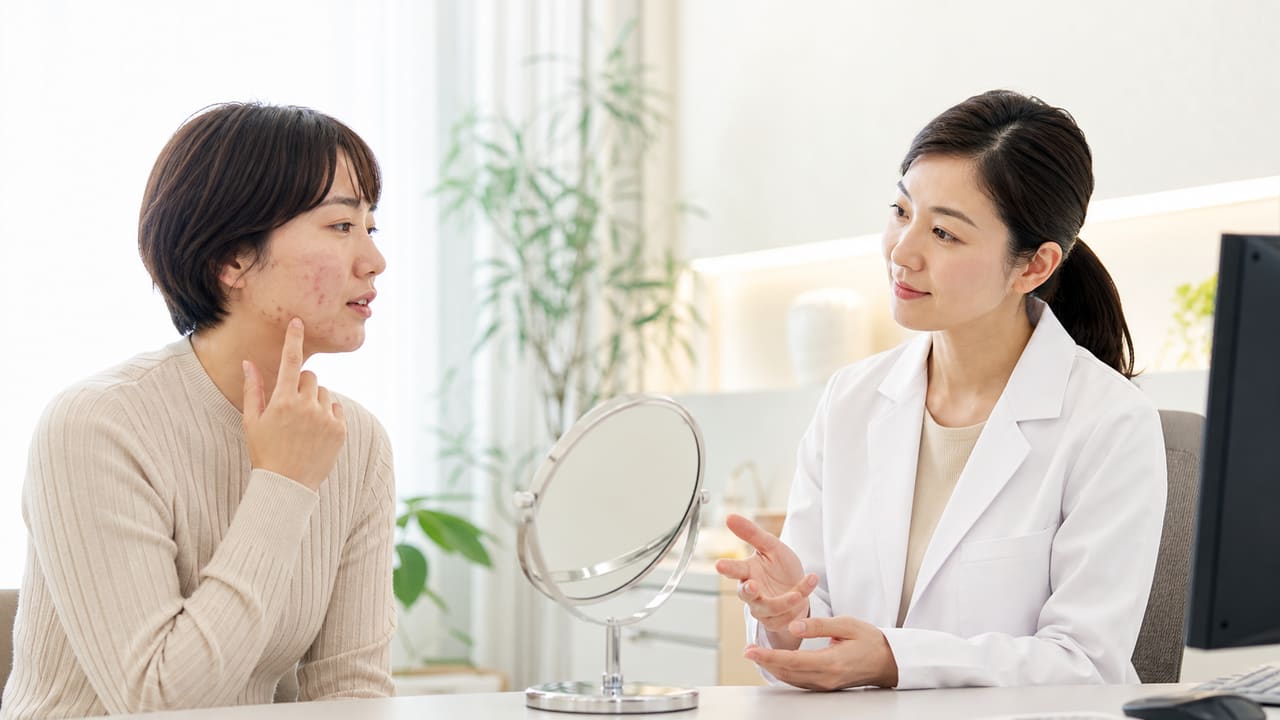 ストレスが続く時期に悪化したニキビを皮膚科医へ相談する成人