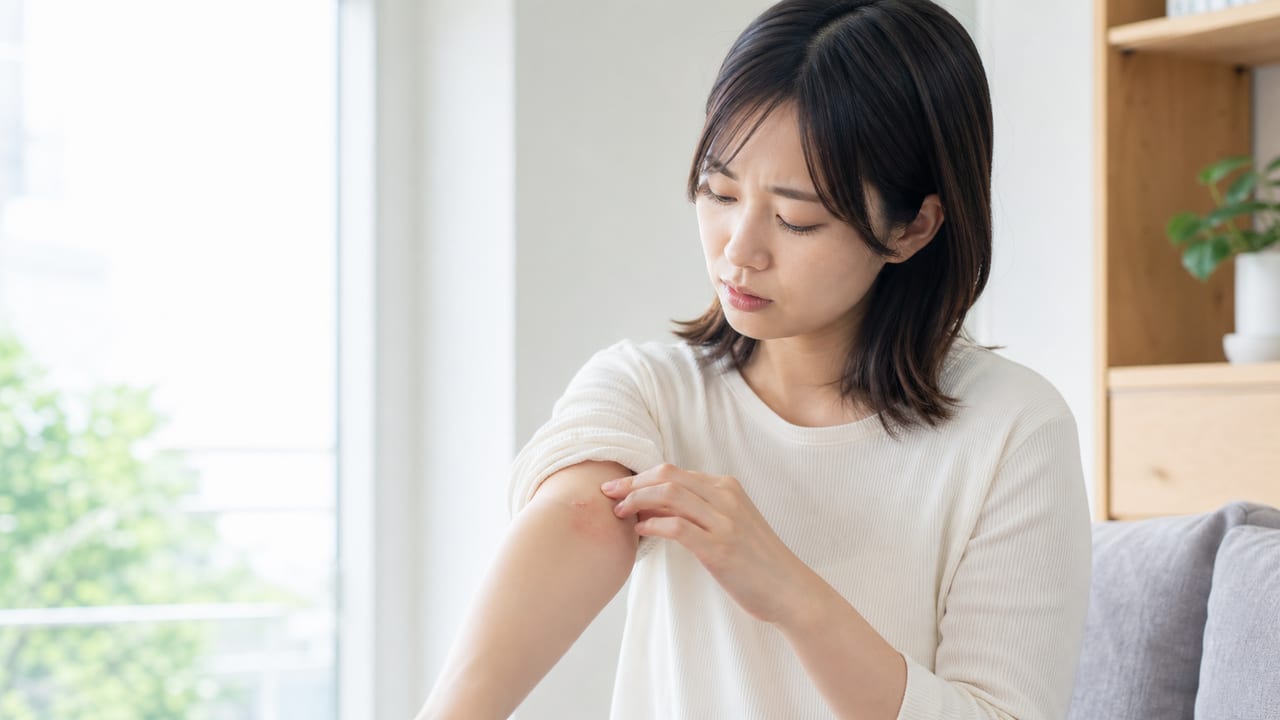 虫刺されによる腕の赤みを確認する患者